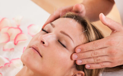 Can Acupuncture Help Your Skin?