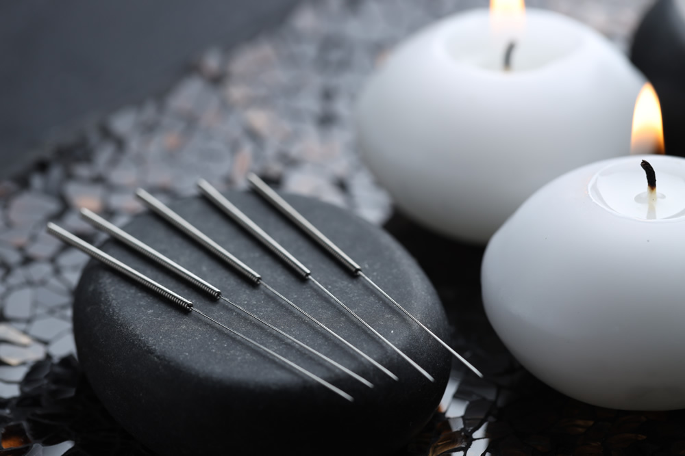 community acupuncture