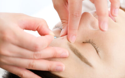 3 Things to Know About Acne Acupuncture