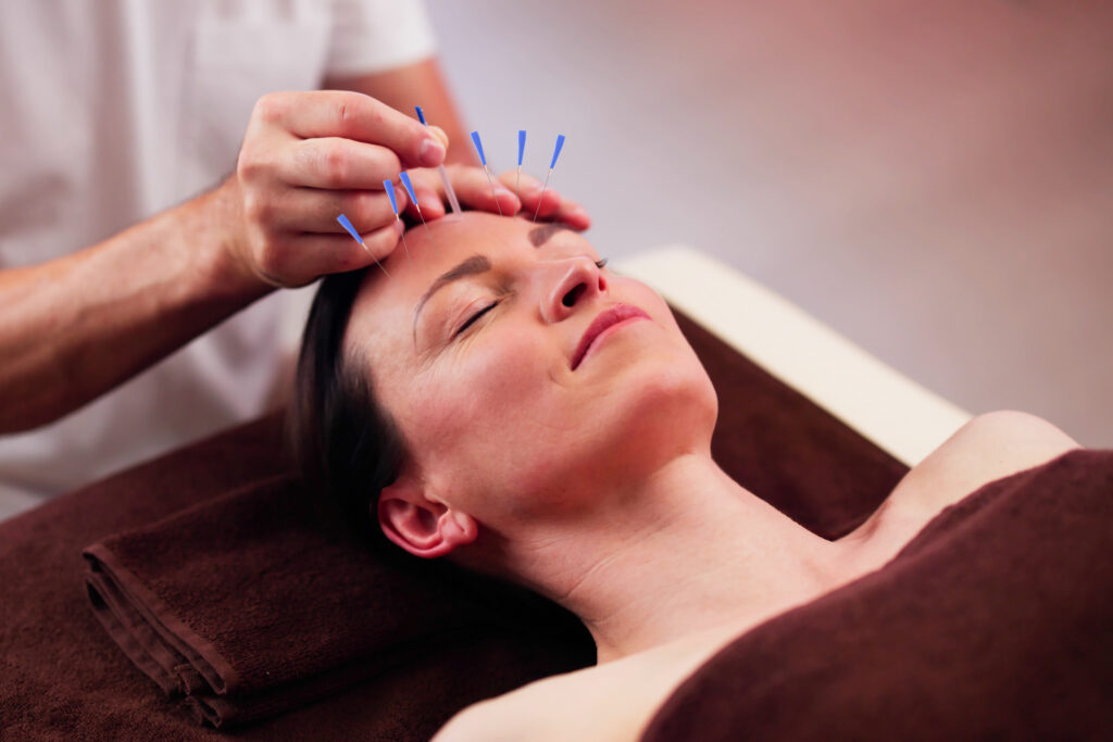 A relaxed young woman receives a facial rejuvenation treatment for cosmetic-acupuncture-vs-Botox blog.
