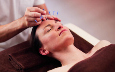 Cosmetic Acupuncture vs. Botox: Natural Anti-Aging Options